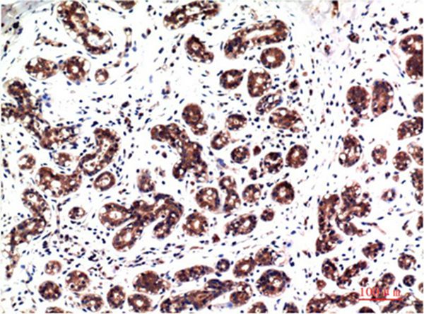 Mouse Monoclonal Antibody to Phospho-ERK 1/2 (Y222/205)Mouse(4G3)