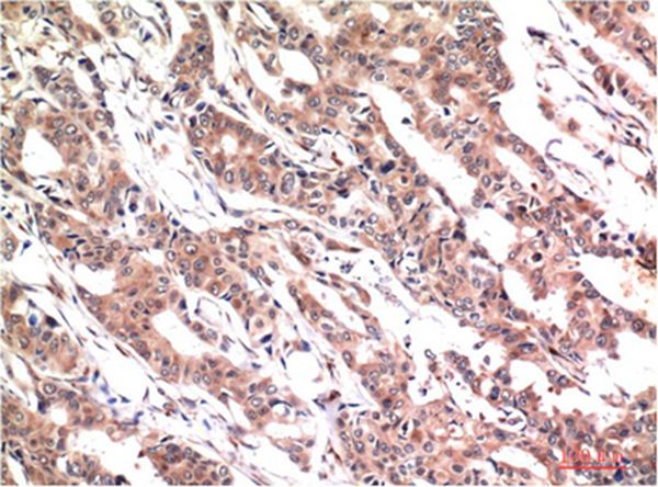 Mouse Monoclonal Antibody to Phospho-Stat3 (Y705) Mouse(1E9)