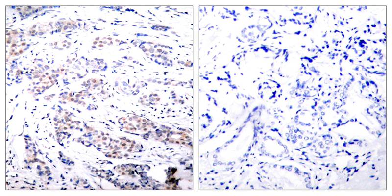 Rabbit Polyclonal Antibody to Elk-1(Ab-383)