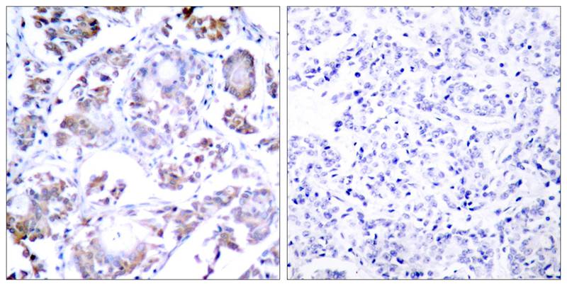 Rabbit Polyclonal Antibody to NFkB-p65(Ab-254)