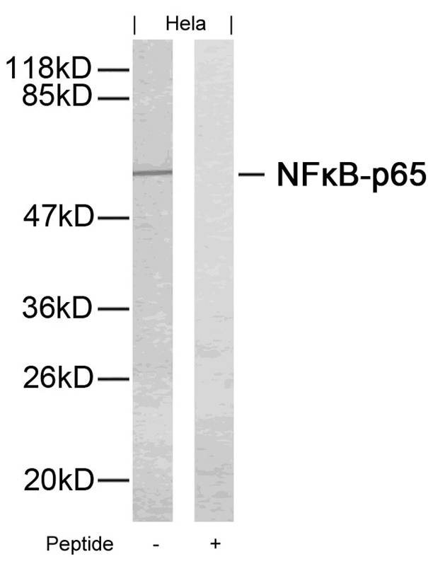 Rabbit Polyclonal Antibody to NFkB-p65(Ab-276)