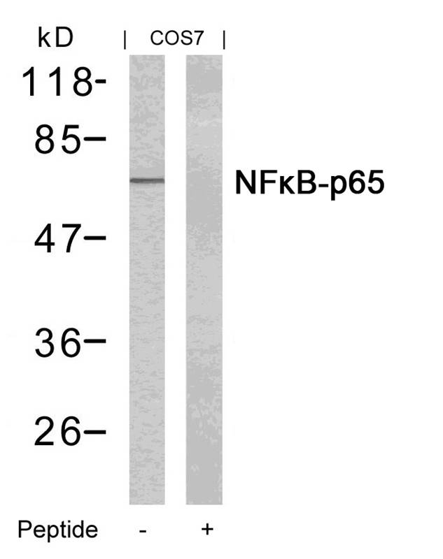 Rabbit Polyclonal Antibody to NFkB-p65(Ab-435)