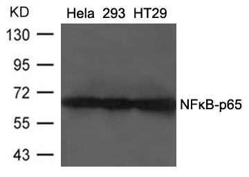 Rabbit Polyclonal Antibody to NFkB-p65(Ab-468)