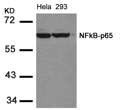 Rabbit Polyclonal Antibody to NFkB-p65(Ab-536)