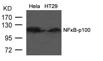 Rabbit Polyclonal Antibody to NFkB-p100(Ab-866)
