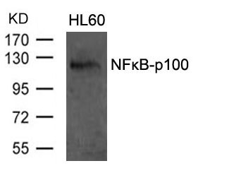 Rabbit Polyclonal Antibody to NFkB-p100(Ab-870)