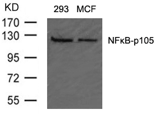 Rabbit Polyclonal Antibody to NFkB-p105(Ab-907)