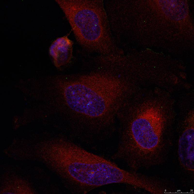 Rabbit Polyclonal Antibody to JunB(Ab-79)