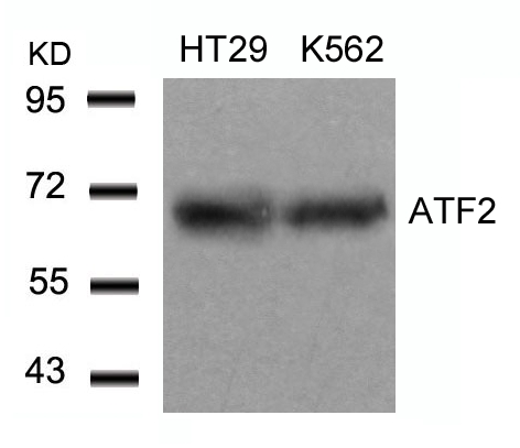 Rabbit Polyclonal Antibody to ATF2(Ab-71 or 53)