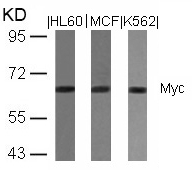 Rabbit Polyclonal Antibody to Myc(Ab-358)