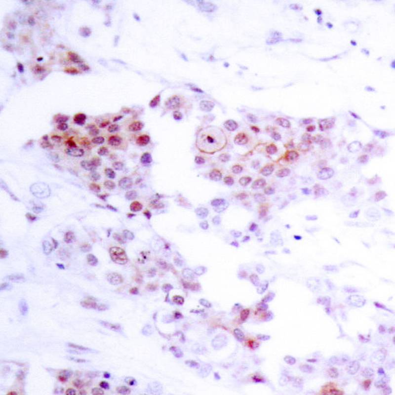 Rabbit Polyclonal Antibody to MEF2a(Ab-319)