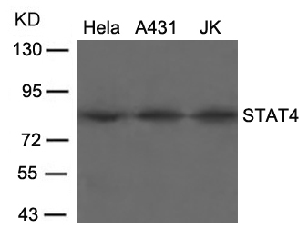 Rabbit Polyclonal Antibody to STAT4(Ab-693)