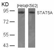 Rabbit Polyclonal Antibody to STAT5a(Ab-694)