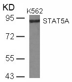 Rabbit Polyclonal Antibody to STAT5a(Ab-780)