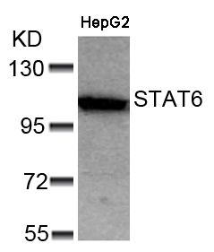 Rabbit Polyclonal Antibody to STAT6(Ab-641)