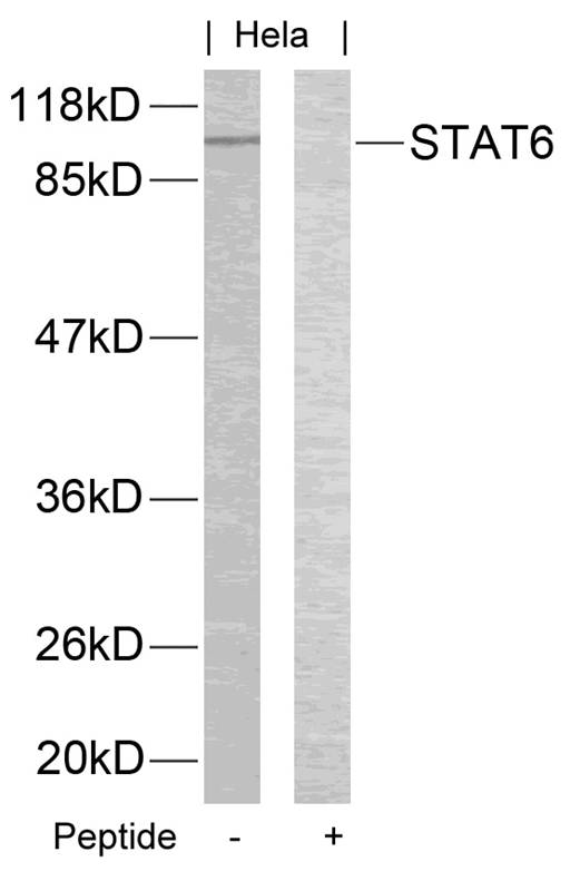 Rabbit Polyclonal Antibody to STAT6(Ab-645)