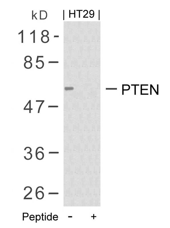 Rabbit Polyclonal Antibody to PTEN(Ab-380/382/383)