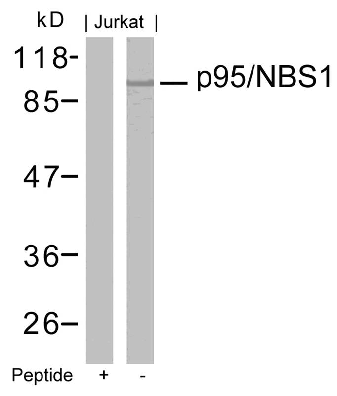 Rabbit Polyclonal Antibody to p95/NBS1(Ab-343)