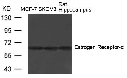 Rabbit Polyclonal Antibody to Estrogen Receptor-a(Ab-104)
