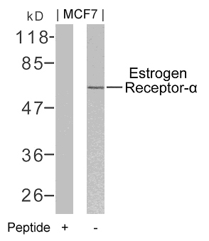 Rabbit Polyclonal Antibody to Estrogen Receptor-a(Ab-106)