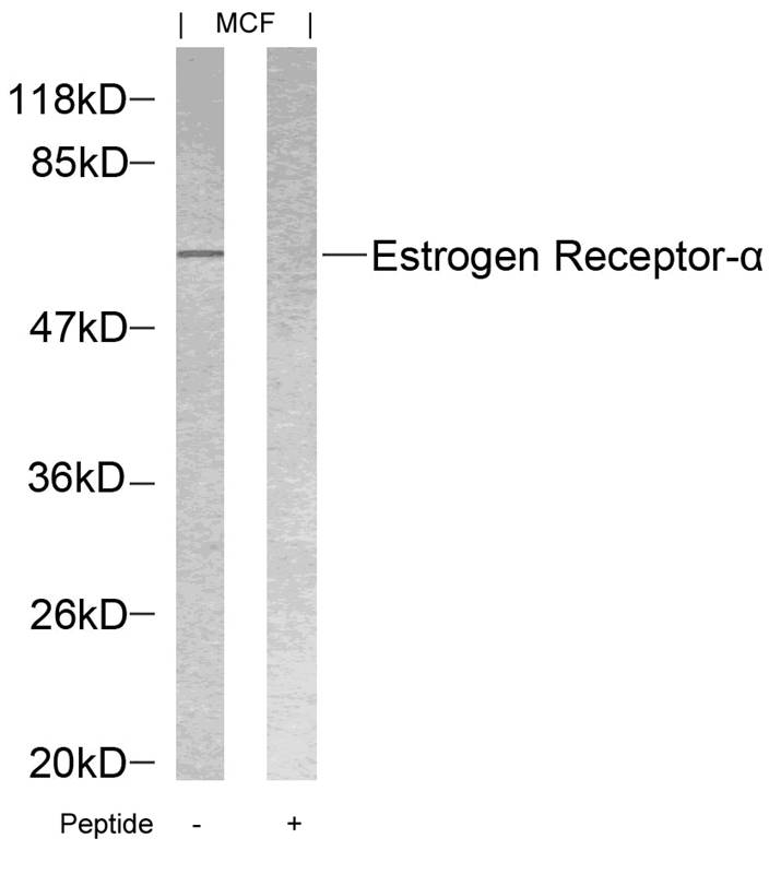 Rabbit Polyclonal Antibody to Estrogen Receptor-a(Ab-118)
