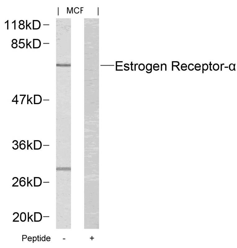 Rabbit Polyclonal Antibody to Estrogen Receptor-a(Ab-167)