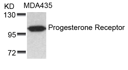 Rabbit Polyclonal Antibody to Progesterone Receptor(Ab-190)