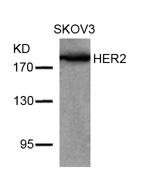 Rabbit Polyclonal Antibody to HER2(Ab-877)