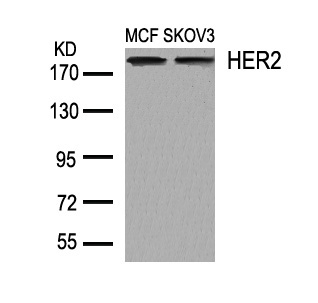 Rabbit Polyclonal Antibody to HER2(Ab-1248)