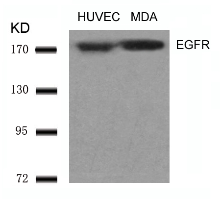 Rabbit Polyclonal Antibody to EGFR(Ab-1070)