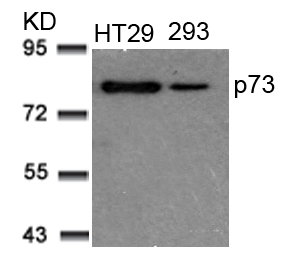 Rabbit Polyclonal Antibody to p73(Ab-99)