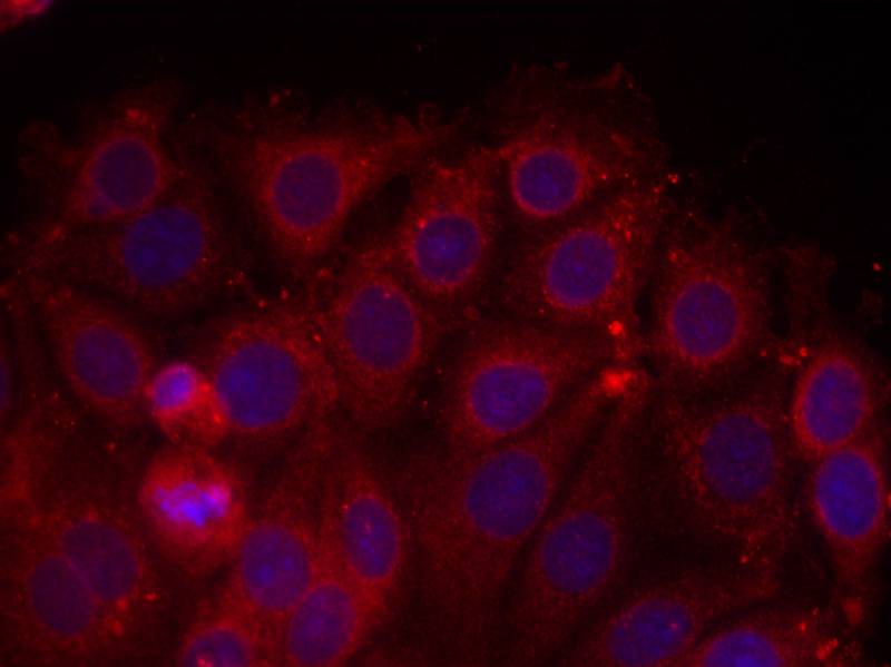 Rabbit Polyclonal Antibody to VEGFR2(Ab-1175)