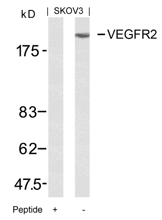 Rabbit Polyclonal Antibody to VEGFR2(Ab-951)