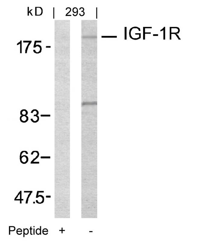 Rabbit Polyclonal Antibody to IGF-1R(Ab-1161)