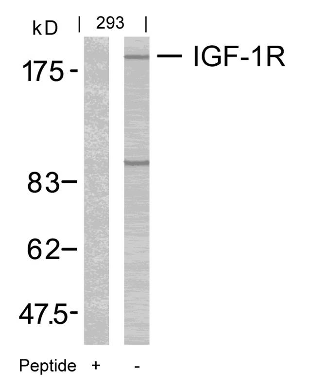 Rabbit Polyclonal Antibody to IGF-1R(Ab-1165/1166)