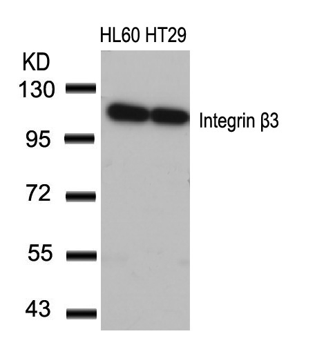 Rabbit Polyclonal Antibody to Integrin b3(Ab-773)