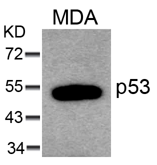 Rabbit Polyclonal Antibody to p53(Ab-6)