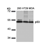 Rabbit Polyclonal Antibody to p53(Ab-9)