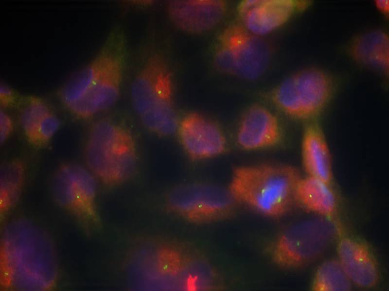 Rabbit Polyclonal Antibody to Tau(Ab-356)