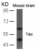 Rabbit Polyclonal Antibody to Tau(Ab-396)