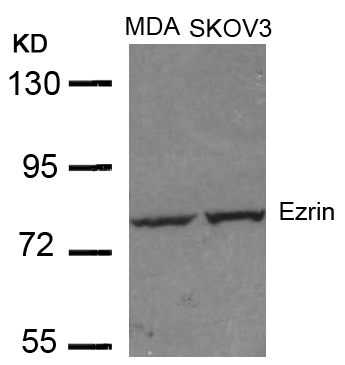 Rabbit Polyclonal Antibody to Ezrin(Ab-353)