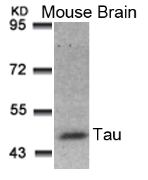 Rabbit Polyclonal Antibody to Tau(Ab-181)