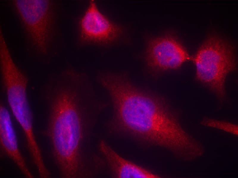 Rabbit Polyclonal Antibody to Tau(Ab-214)