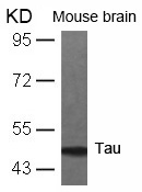 Rabbit Polyclonal Antibody to Tau(Ab-231)