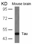 Rabbit Polyclonal Antibody to Tau(Ab-404)