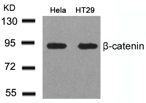 Rabbit Polyclonal Antibody to b-Catenin(Ab-41/45)