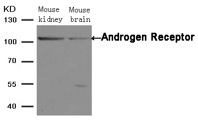 Rabbit Polyclonal Antibody to Androgen Receptor(Ab-650)