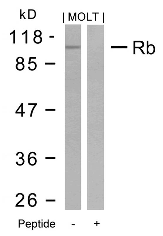 Rabbit Polyclonal Antibody to Rb(Ab-795)