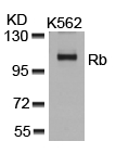Rabbit Polyclonal Antibody to Rb(Ab-807)
