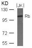 Rabbit Polyclonal Antibody to Rb(Ab-780)
